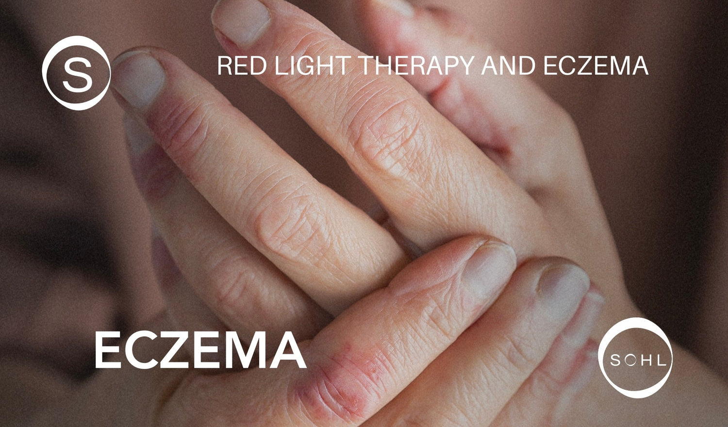Red Light Therapy and Eczema